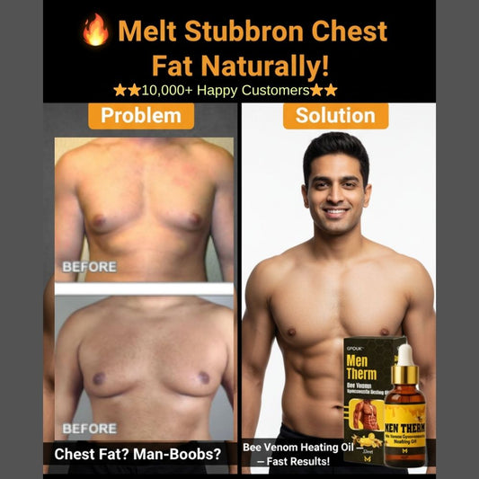 - Chest Fat Bee Venom Gynecomastia Heating Oil - Ummati Essentials